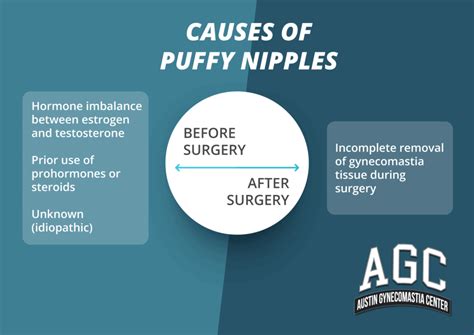 what causes puffy nipples|Puffy Nipples: Causes, Treatments, And Expectations 